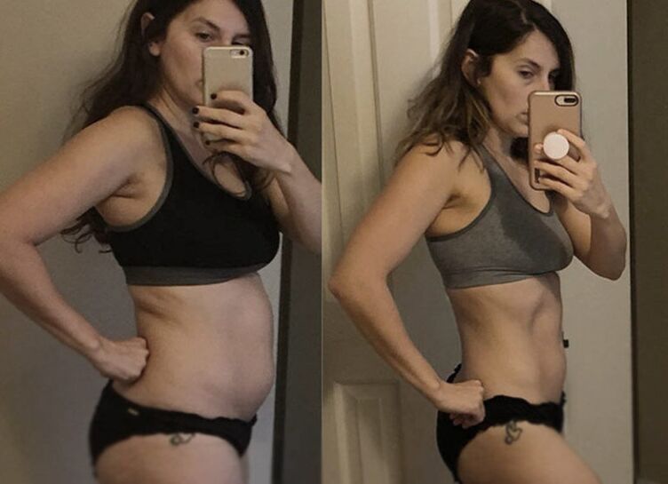 Dziewczyna przed i po diecie ketonowej